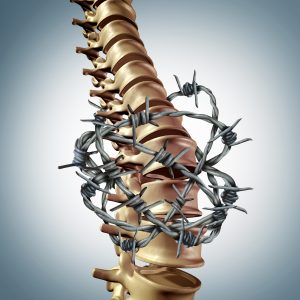 Disc Degeneration, Herniation and Arthritis Explained - Featured Image